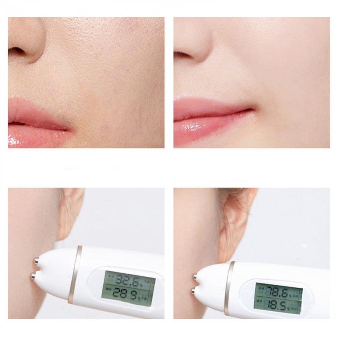 비오아쿠아 본질 좌창 혈청
