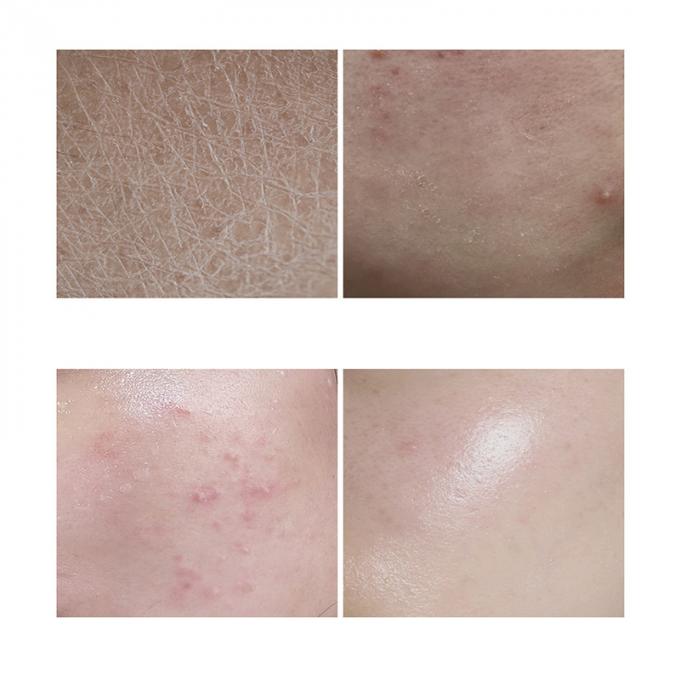 30 밀리람베르트 본질 얼굴 혈청 100% 순수한 빨강 빛을 내는 피부 진보적 주사 1