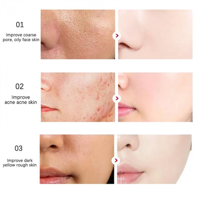 30 밀리람베르트 본질 얼굴 혈청 100% 순수한 빨강 빛을 내는 피부 진보적 주사 1