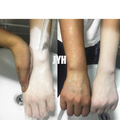 크림 안전한 피부 라이트닝 크림을 미백하는 크리스탈 1000g 미
