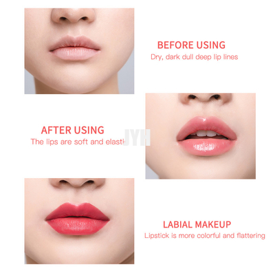 Lip 관목숲 박리제 핑크색 LIP 향유와 관목숲 10g를 밝히는 OEM