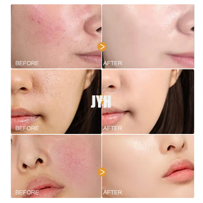 MSDS 페이셜 스킨 케어 제품 유기농 카모마일 꽃잎 세럼 민감한 피부를 위한 천연 페이셜 세럼