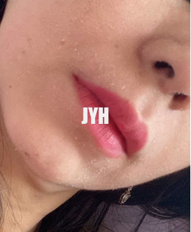10% 글리콜산 수화 얼굴 토너 100 밀리람베르트 피부 관리 화학 박피는 피부를 밝게 합니다